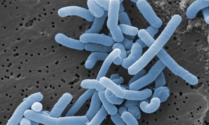 Lactobacillus paracasei Postbiotics